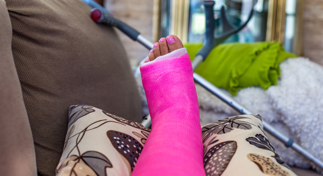 Been in het gips